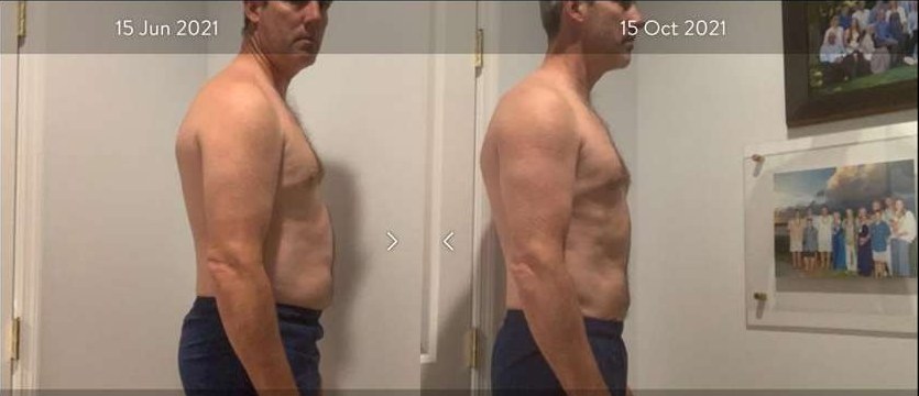 Eddie, before and after, side view