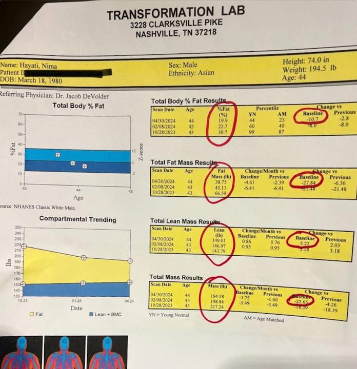 Nima, body composition scan